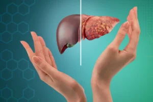 7 Early Signs of Fatty Liver فیٹی لیور کے 7 ابتدائی اشارے